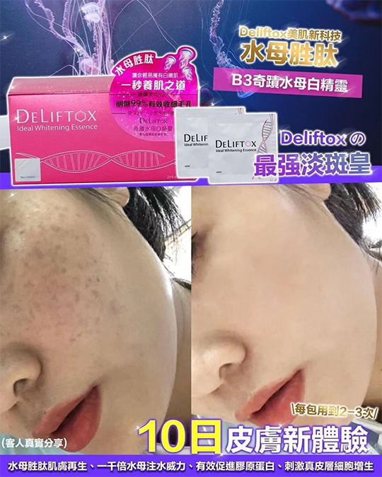 奇蹟水母白精靈