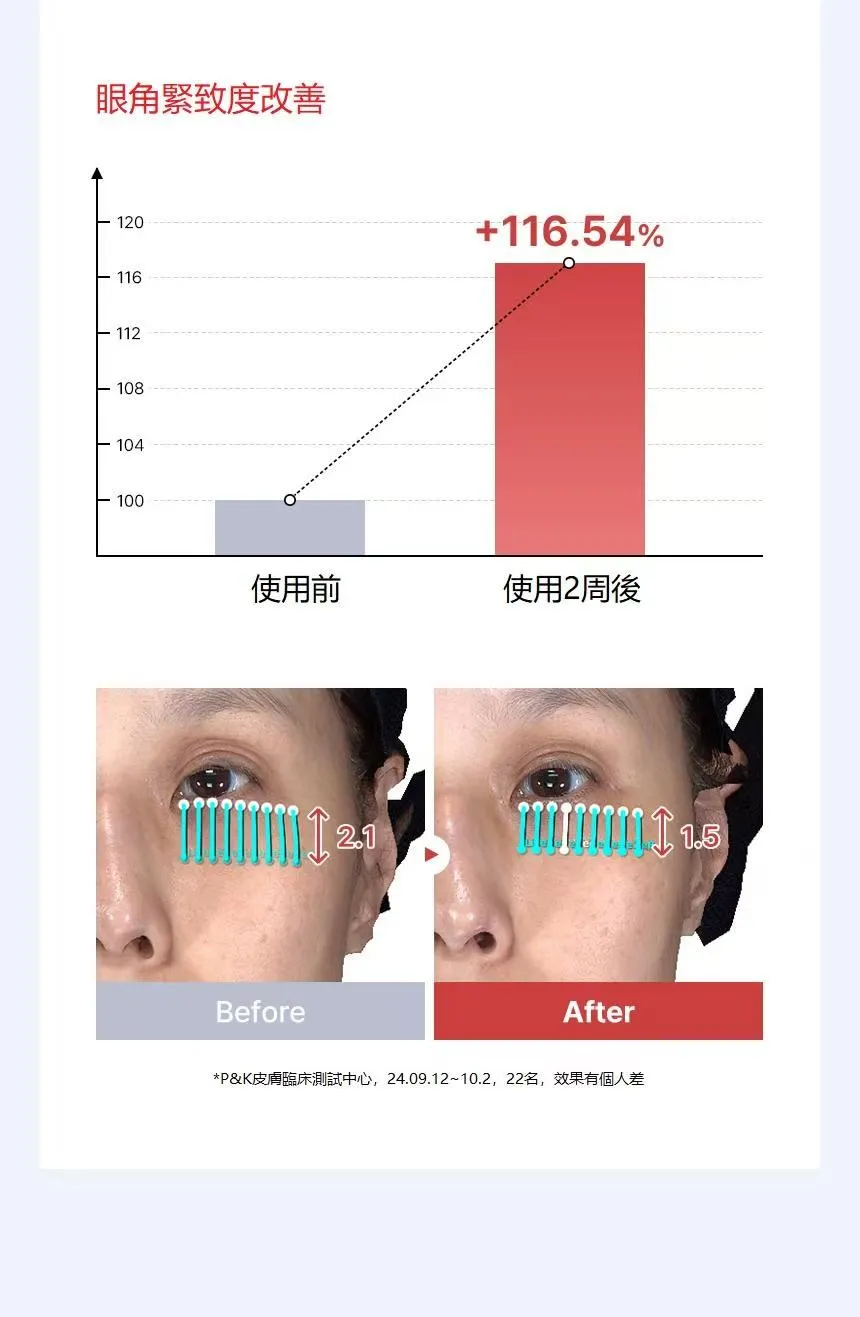 Franz 小紅盒 EGF精華 50ML