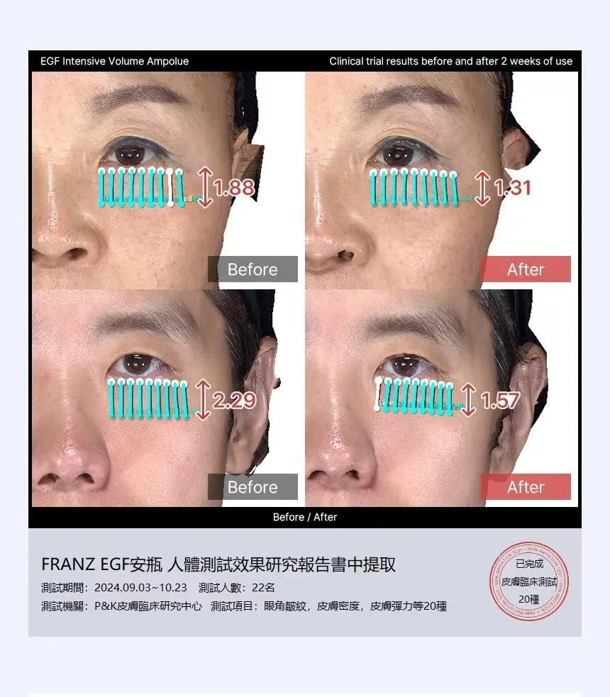 Franz 小紅盒 EGF精華 50ML