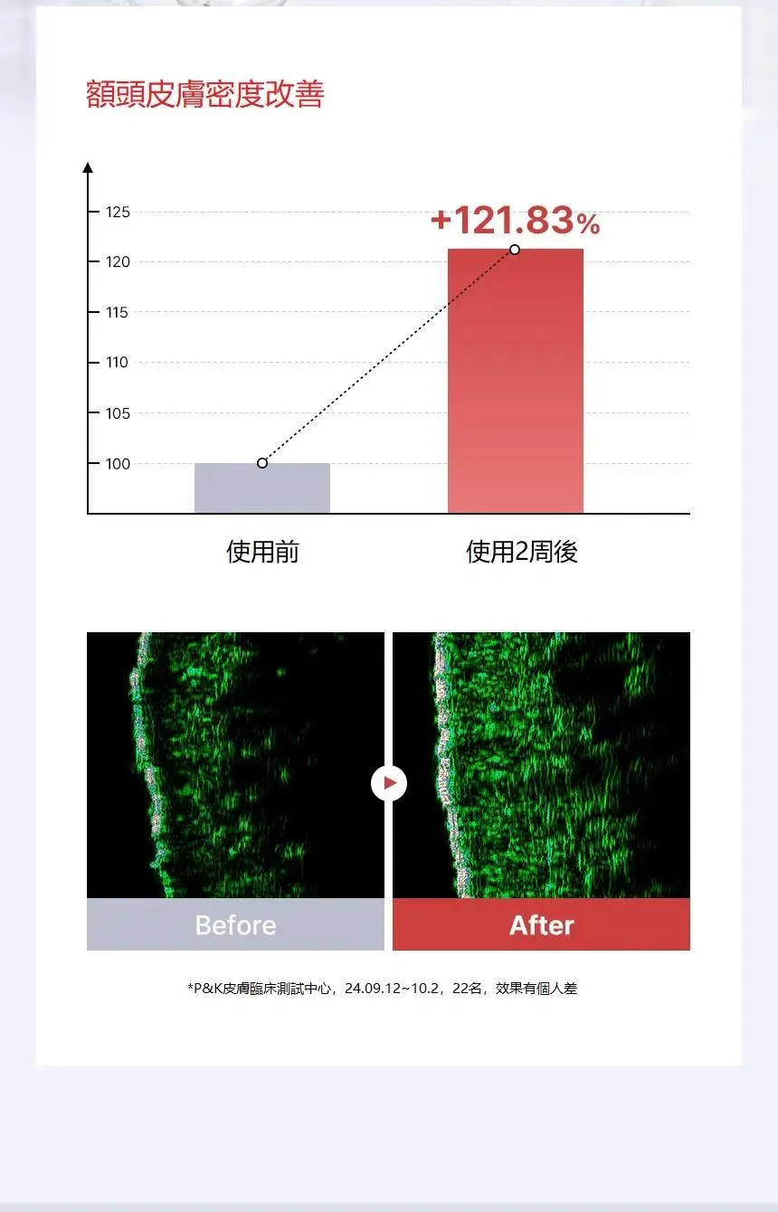 Franz 小紅盒 EGF精華 50ML